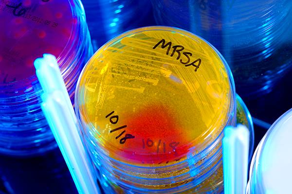 Petri dish with MRSA